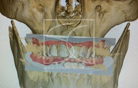 Ortodonzia Ragusa Laboratorio odontotecnico SC